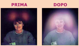 before,after